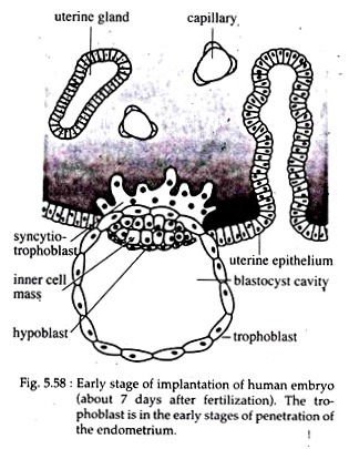 human blastocyst implantation